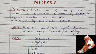 What Is Necrosis  Types Of Necrosis  Gross amp Microscopy  Pathology [upl. by Draw]