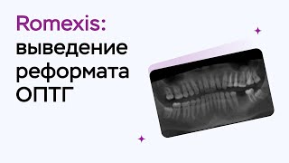 Возможности программы Romexis Viewer выведение реформата ОПТГ [upl. by Duke]