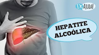 HEPATITE ALCOÓLICA E CIRROSE SINTOMAS DIAGNÓSTICO E TRATAMENTO [upl. by Yroc889]