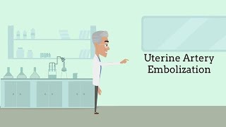 Uterine Fibroid Embolization Fibroids No Surgery Required [upl. by Helbona]