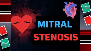 Mitral Valve Stenosis [upl. by Salomone]