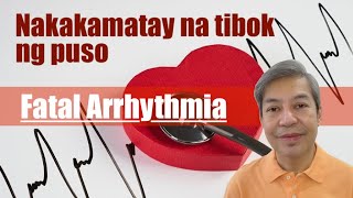 Nakakamatay na tibok ng puso Fatal arrhythmia [upl. by Ymrej]