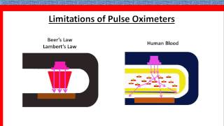 pulse oximetry [upl. by Moody]