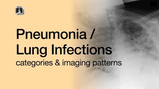 Pneumonia  Lung Infections [upl. by Enrobialc]