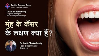 मुंह के कैंसर के लक्षण क्या हैं  What are the Symptoms of Mouth Cancer  Dr Amit Chakraborty [upl. by Omari]