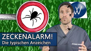 Zecken Alarm Achten Sie auf diese typischen Alarmzeichen nach Zeckenbiss Hautrötung Wanderröte [upl. by Shira693]