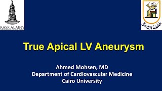 True Apical LV aneurysm [upl. by Scever388]