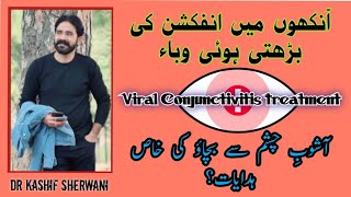 Viral Conjunctivitis Cases Symptoms And Complete Homeopathic Treatment [upl. by Harad]