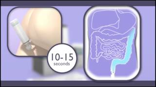 Rectal Treatment for Inflammatory Bowel Disease [upl. by Cohl]