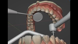 Instruments positioning for indirect vision Maxillary premolar crown preparation under microscope [upl. by Claudette]