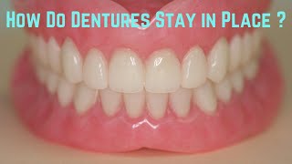 How do dentures stay in place [upl. by Nylla]