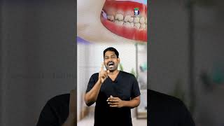 வலி இல்லாத மேல் ஞானப்பல்லை ஏன் எடுக்க வேண்டும் Why to extract upper wisdom tooth DrKarthikeyan [upl. by Katy190]