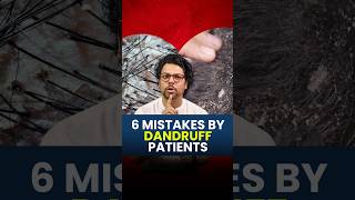 6 Mistakes By Dandruff Patients  Hair Loss  Hair Regrowth  Dry Dandruff  Greasy Dandruff viral [upl. by Ettinger]