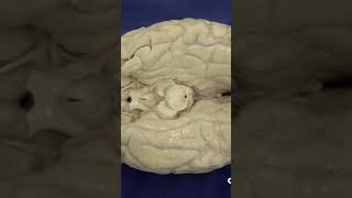 Cerebral peduncles in midbrain anatomy brainanatomy neuroanatomy [upl. by Ken439]