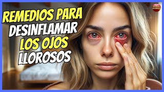 🔴 REMEDIOS CASEROS PARA DESINFLAMAR LOS OJOS LLOROSOS 🔴 [upl. by Adiana284]