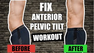 FIX quotAnterior Pelvic Tiltquot FAST  15 Min Home Workout INSTANT quotLOW BACKquot PAIN RELIEF [upl. by Giarla]