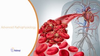 Advanced Pathophysiology [upl. by Aramit]