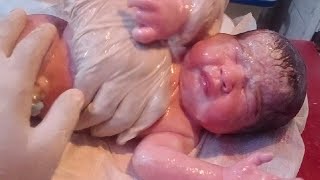 New born baby cleaning removed vernix baby oil is used baby need good cleaning looking so beautifull [upl. by Elli]