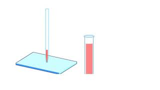 A Human Karyotype Preparation Animation [upl. by Arhna]