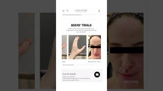 Stem Cell Skincare Results You WONT Believe [upl. by Fridell]