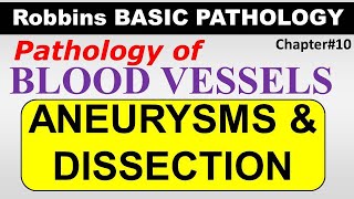 Ch12  Aneurysms amp Dissection  Blood Vessel Pathology  Robbins Lectures [upl. by Inaffets]