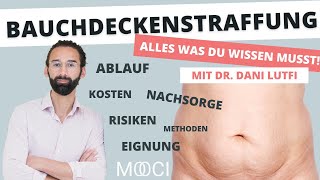 Bauchdeckenstraffung  Alle Informationen zur Behandlung [upl. by Yeniar124]