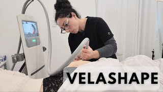 Shape Up with VelaShape III Your Ultimate Guide to Body Contouring [upl. by Prentice612]