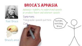 Brocas Aphasia Expressive Aphasia [upl. by Faust]