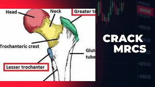 Lesser trochanter of femur MRCS question solve [upl. by Tat]