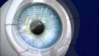 Intralase Educational Video  Laser Eye Surgery [upl. by Publea]