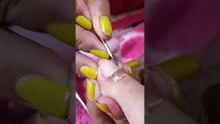 cleaning toenail videos pedicure subscribe [upl. by Wagshul]