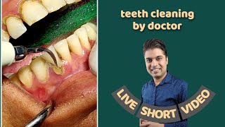 teeth cleaning by doctor । dentist preparing for teeth cleaning or removing tartar by machine [upl. by Ormond]