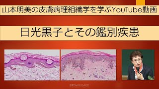 日光黒子とその病理組織学的鑑別疾患 dermatopathology 山本明美 lentigo [upl. by Jada337]