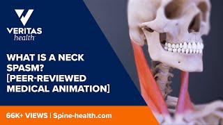 Neck Spasms Peerreviewed Medical Animation [upl. by Eeleak411]