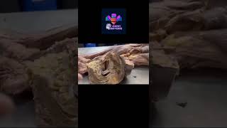 Anatomy lab dissection mbbs neet study biology [upl. by Hareenum]