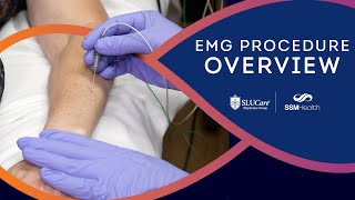 The EMG Procedure Overview of the Nerve Conduction Study Process [upl. by Tabber]