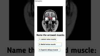 Anatomy Quiz 🔍 Identify the Muscle learningradiology medicalimaging medicalquiz [upl. by Jenkel]