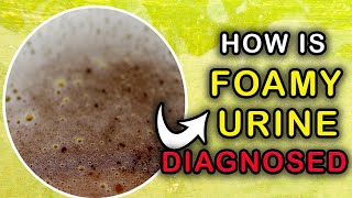 How to IDENTIFY the Cause of FOAM IN URINE  Foamy Urine Diagnosis [upl. by Elle835]