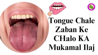 Tongue Chale Zaban Ke CHalo KA Mukamal Ilaj  Mouth Ulcer Ka Ilaj [upl. by Hallutama222]