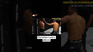 Christian Lees elbow [upl. by Hynes]