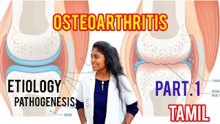 osteoarthritis  causespathophysiology clinical features part 1 in tamil [upl. by Eleinad]