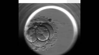 EmbryoScope  artificial fertilization technique [upl. by Barnum]