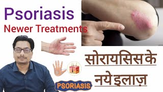 सोरायसिस के नये इलाज़  Psoriasis Newer Treatments  Tofacitinib  Infliximab  Adalimumab psoriasis [upl. by Yenffad]