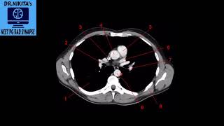 PART2  CT THORAX NORMAL ANATOMY [upl. by Duarte]