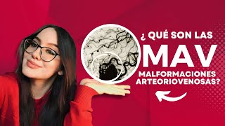 ¿Qué son las MAV Malformaciones Arteriovenosas Causas Síntomas y Tratamientos [upl. by Shanney921]