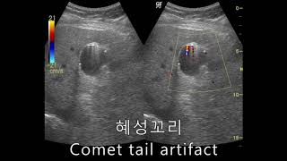 comet tail artifact 혜성 꼬리 2 [upl. by Salomon221]