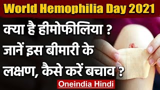 World Hemophilia Day 2021 क्या है हीमोफीलिया जानें इस बीमारी के लक्षण और बचाव   वनइंडिया हिंदी [upl. by Jaquith]