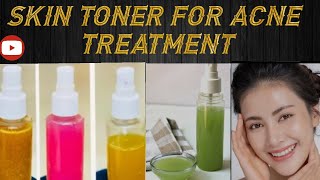 Best skin Toner for oily skinDiy AntiAgeing skin toner for glowing tighting and spotless skin [upl. by Trebo]