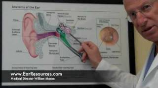 quotTreatable Causes of Hearing Lossquot Hearing Loss Newton MA Part 2 [upl. by Ydna]