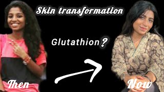 SKIN TRANSFORMATION😵‍💫🫂  RESULT  TRANSFORMATION  MALAYALAM [upl. by Hgielrac]